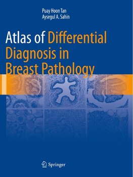 Atlas of Differential Diagnosis in Breast Pathology