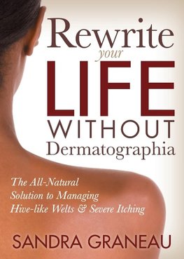 Rewrite Your Life Without Dermatographia