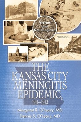 The Kansas City Meningitis Epidemic, 1911-1913