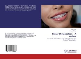 Molar Distalization - A review