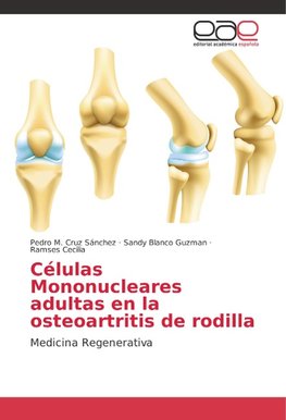 Células Mononucleares adultas en la osteoartritis de rodilla