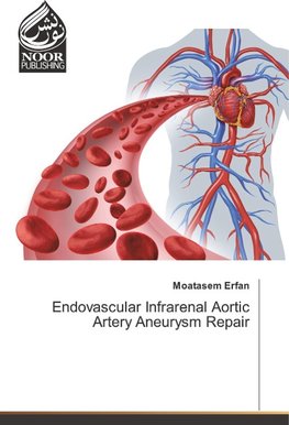 Endovascular Infrarenal Aortic Artery Aneurysm Repair