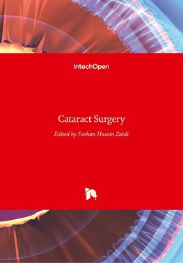 Cataract Surgery