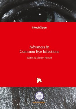 Advances in Common Eye Infections