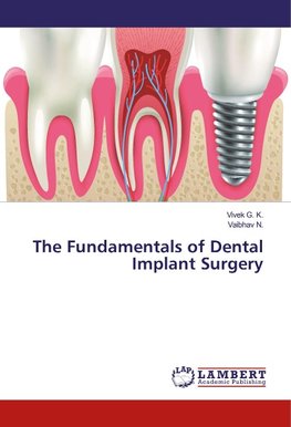 The Fundamentals of Dental Implant Surgery