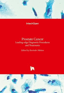 Prostate Cancer