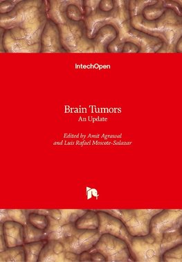 Brain Tumors