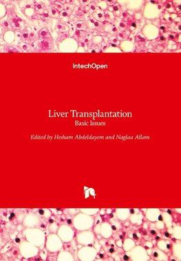 Liver Transplantation