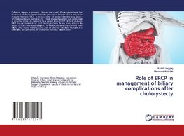 Role of ERCP in management of biliary complications after cholecystecty