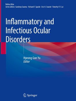 Inflammatory and Infectious Ocular Disorders