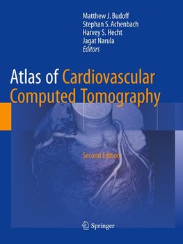 Atlas of Cardiovascular Computed Tomography