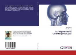 Management of Odontogenic Cysts