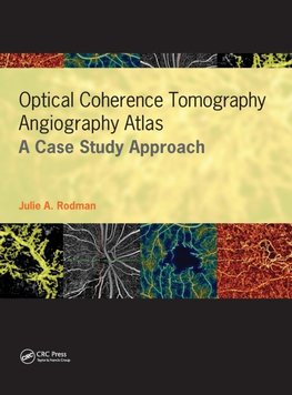 Optical Coherence Tomography Angiography Atlas