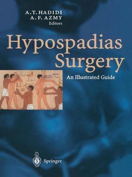 Hypospadias Surgery