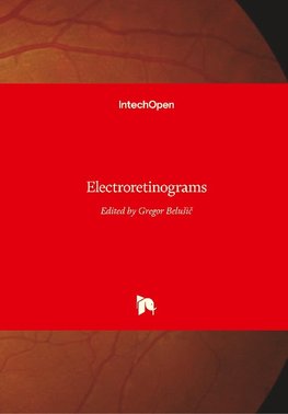 Electroretinograms