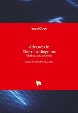 Advances in Electrocardiograms