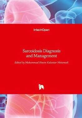 Sarcoidosis