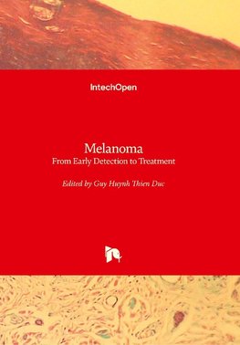 Melanoma