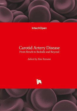 Carotid Artery Disease