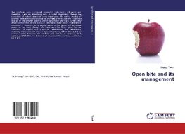 Open bite and its management