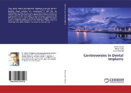 Controversies in Dental Implants