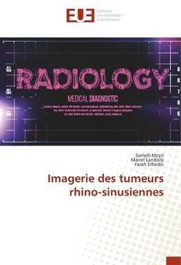 Imagerie des tumeurs rhino-sinusiennes