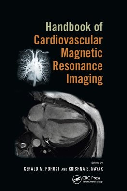 Handbook of Cardiovascular Magnetic Resonance Imaging