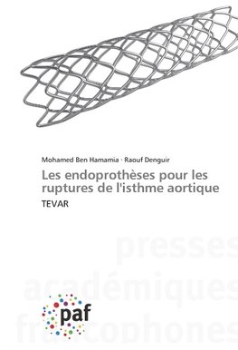 Les endoprothèses pour les ruptures de l'isthme aortique