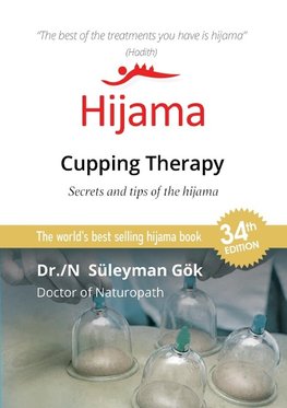 Hijama