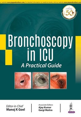 Bronchoscopy in IC