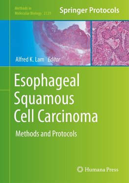 Esophageal Squamous Cell Carcinoma