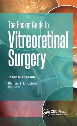 The Pocket Guide to Vitreoretinal Surgery