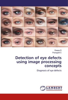 Detection of eye defects using image processing concepts