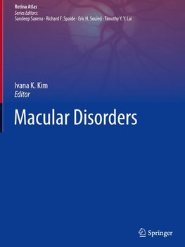 Macular Disorders