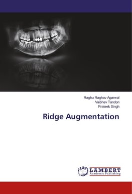 Ridge Augmentation