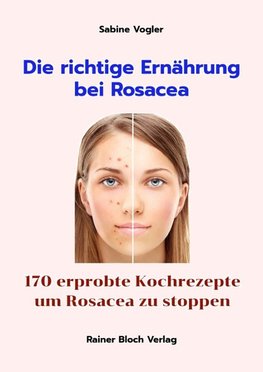 Die richtige Ernährung bei Rosacea