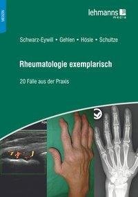 Rheumatologie exemplarisch