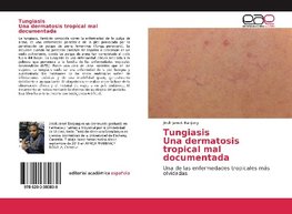 TungiasisUna dermatosis tropical mal documentada