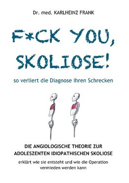 F*ck you, Skoliose! So verliert die Diagnose ihren Schrecken