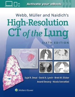 Webb, Muller and Naidich's High Resolution of Lung CT