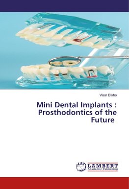 Mini Dental Implants : Prosthodontics of the Future