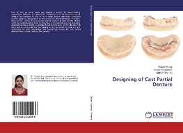 Designing of Cast Partial Denture