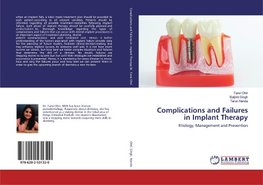 Complications and Failures in Implant Therapy