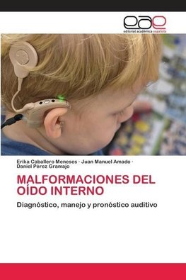 MALFORMACIONES DEL OÍDO INTERNO