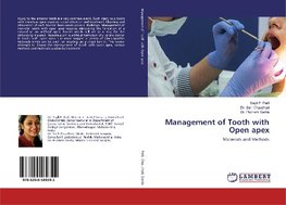 Management of Tooth with Open apex