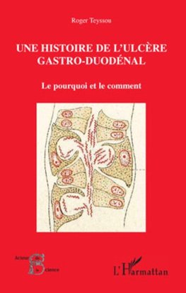 Une histoire de l'ulcère gastro-duodénal