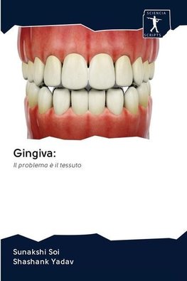 Gingiva: