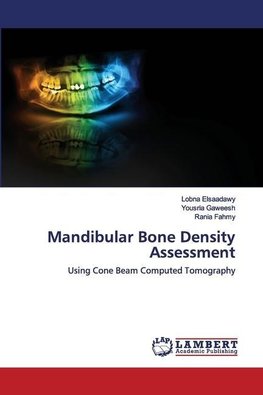 Mandibular Bone Density Assessment