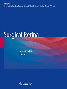 Surgical Retina