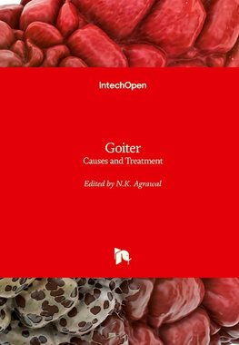 Goiter